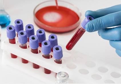 وخزة إصبع تكشف الزهايمر قبل ظهور الأعراض #صحيفة_الخليج 