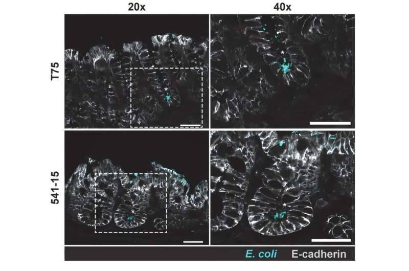 إشارات في الأمعاء تحمي من الأمراض الالتهابية #صحيفة_الخليج 