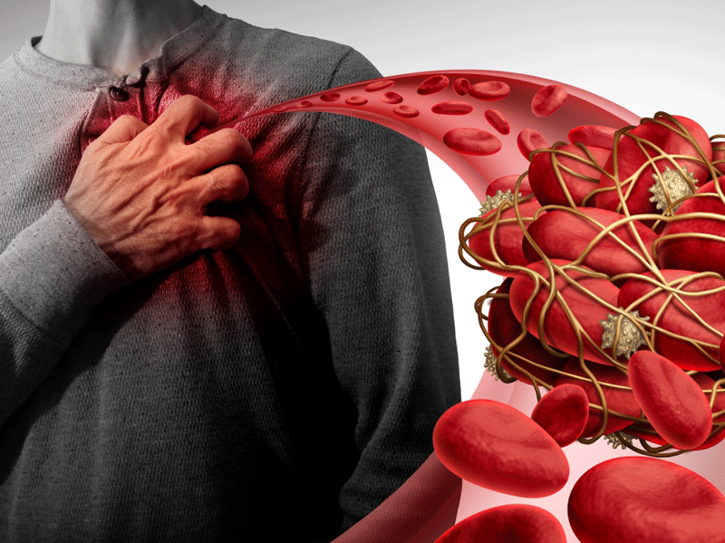 اضطراب الصفائح الدموية يسبب مشكلات خطرة صحيفة الخليج
