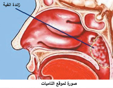 اللحمية طريق التهابات الجيوب الأنفية صحيفة الخليج