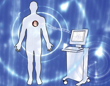 مراقبة السرطان بشريحة إلكترونية تزرع في الجسم