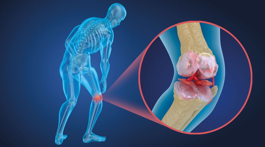 نسيج غضروفي صناعي يشبه الطبيعي