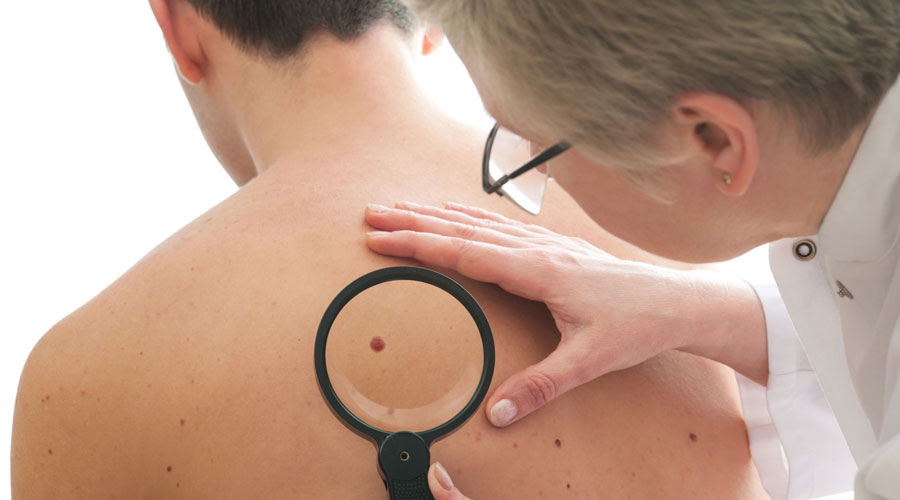 آلية تحييد السرطان للمناعة