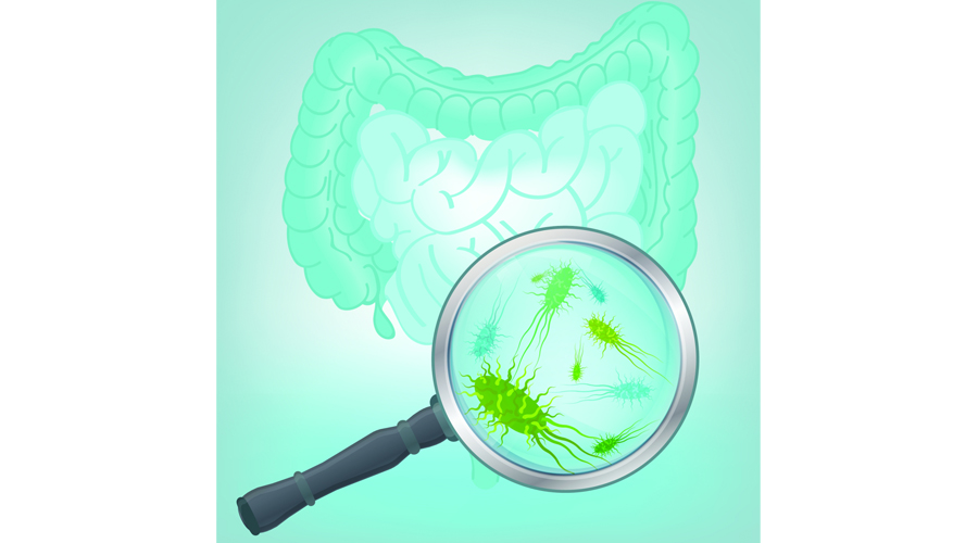 بكتيريا معوية معينة ترتبط بالقولون العصبي