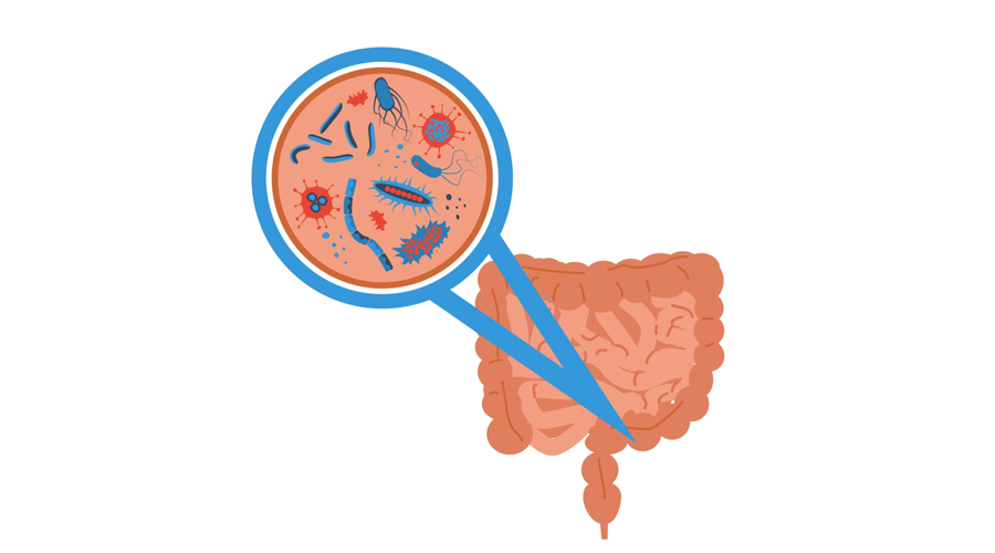 تأثير مباشر لبكتيريا الأمعاء في المناعة الجسدية