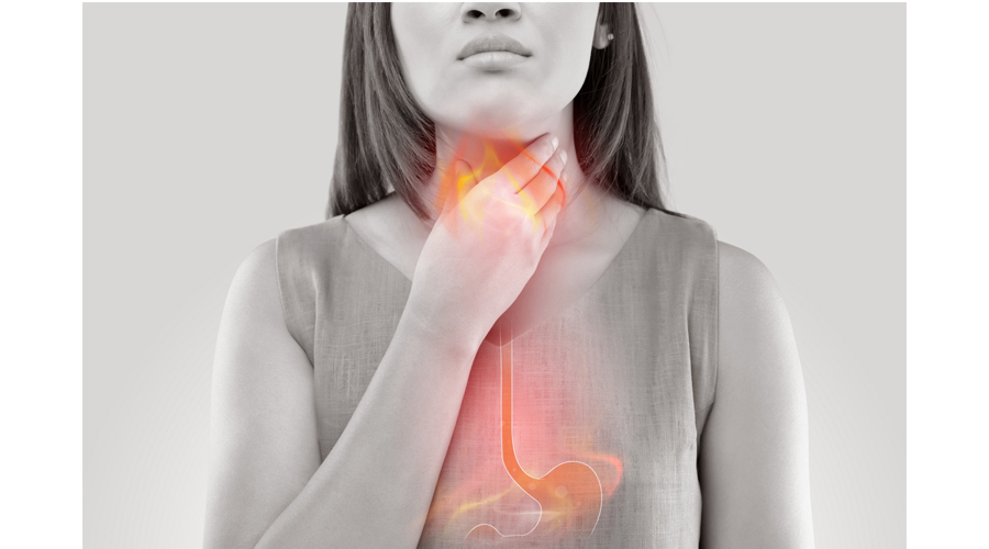 حبوب حرقة المعدة.. علاج ومشاكل مزمنة