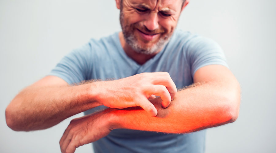 تحديد الإنزيم الرئيســـي في أمراض المناعة الذاتية