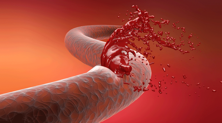 فقد ثلث الدم.. حـالة طـــبية حــرجة