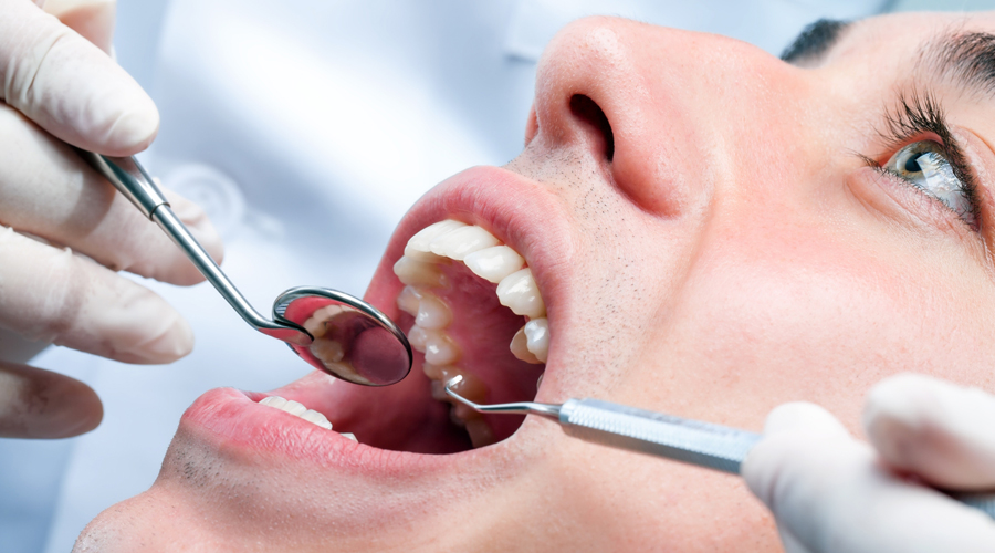 علاج التهاب اللثة بوسائط دهنية