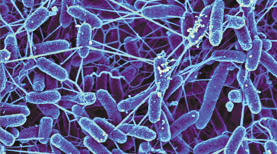 «ميكروبيومات الأمعاء» تعجل بالشيخوخة
