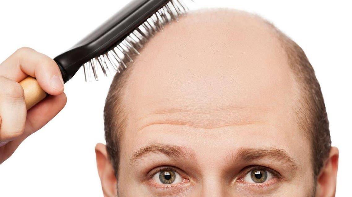 علاج تساقط الشعر بالدواء