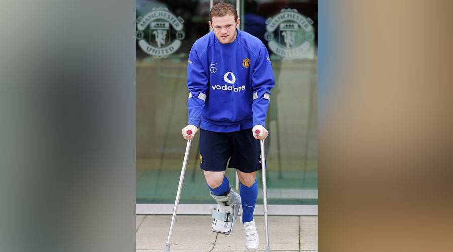 كسر قدم كولين على طريقة روني