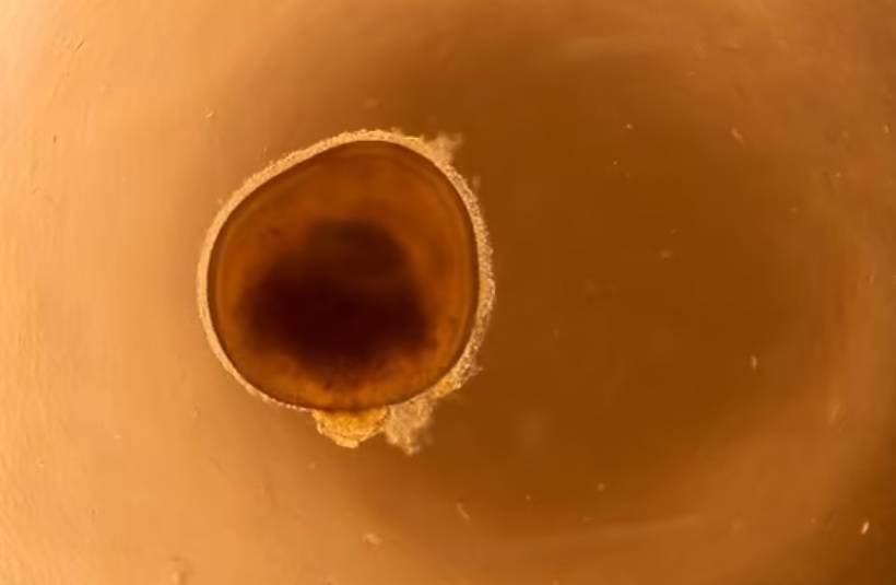 شبكية العين الاصطناعية المبتكرة