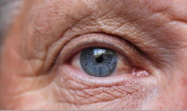 ضعف البصر يرتبط بأمراض القلب