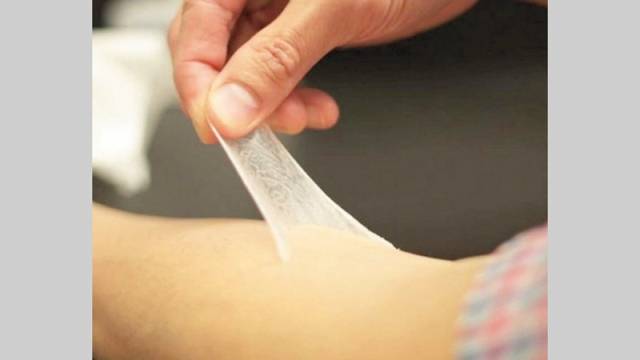 جلد اصطناعي لمعالجة الحروق