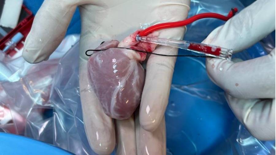 الطفلة الإماراتية أصغر حالة تخضع لعملية زراعة قلب على مستوى الشرق الأوسط