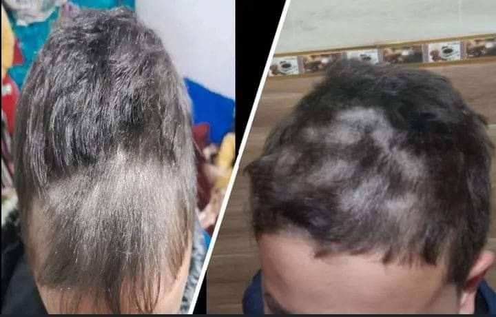 غضب جزائري ضد معلمة عاقبت تلاميذها بحلق شعرهم