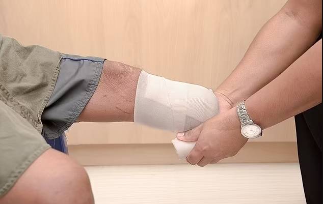 نقص التروية الشديد في الأطراف
