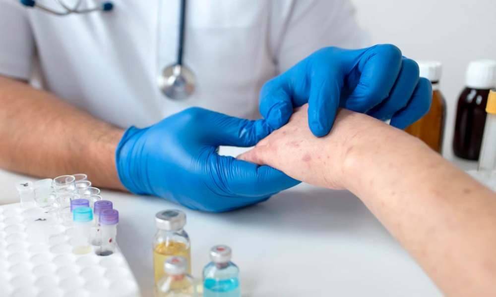 الرابط بين الأمراض الجلدية والروماتيزم