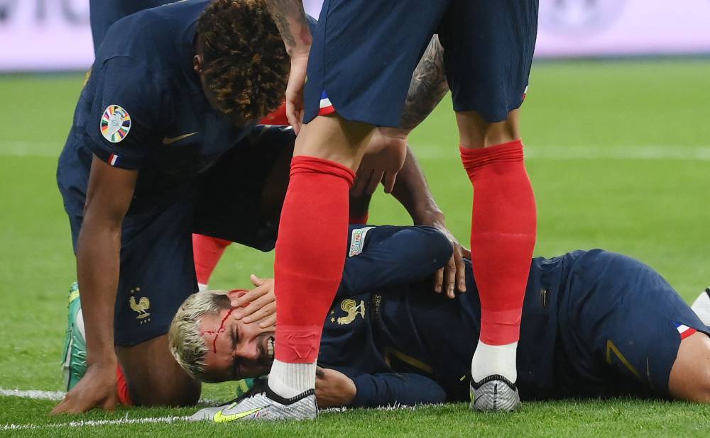 الدماء على وجه غريزمان بعد الركلة