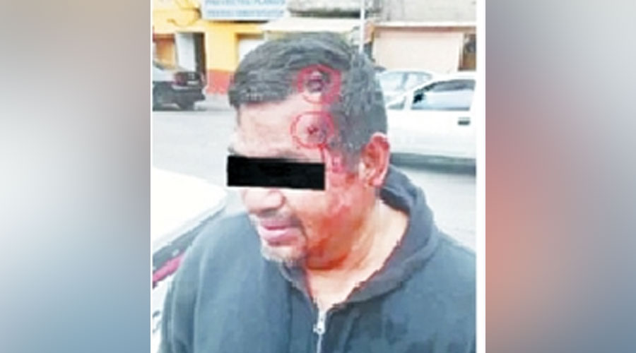  فرانسيسكو بعد الحادث 