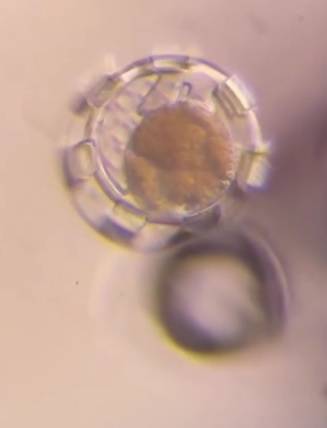 خلال وضع خلايا في مكانها الصحيح بالعين