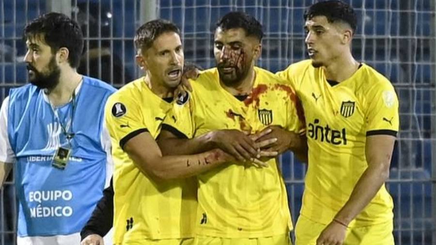  الدماء على قميص أوليفيرا 