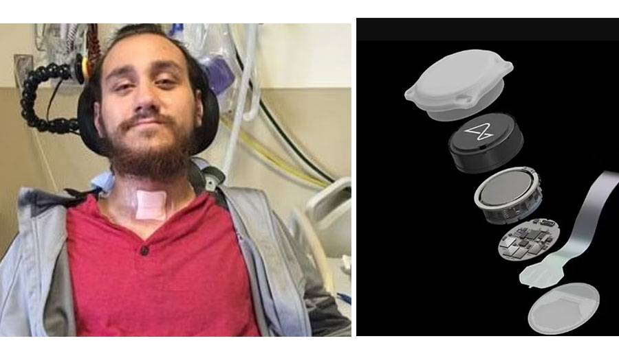قطع الشريحة - نولان أربو