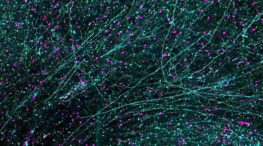 خريطة ثلاثية الأبعاد خلايا دماغ مكتمل
