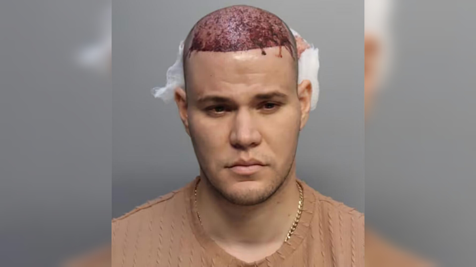 رأسه ملطخ بالدماء.. طرد مسافر من رحلة جوية أمريكية