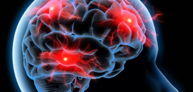 عقار صرع يقلل أعراض انقطاع التنفس أثناء النوم