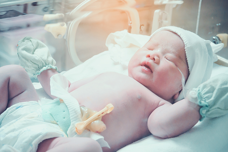 الولادة المبكرة: خطر قاتل يدوم عقوداً