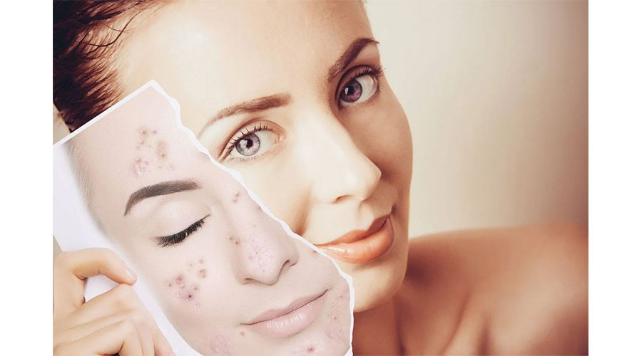 4 عادات يومية تكافح شيخوخة الجلد