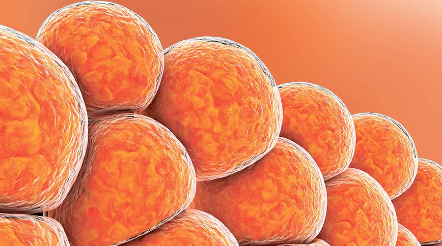 اكتشاف مجموعة فرعية جديدة من الخلايا الدهنية