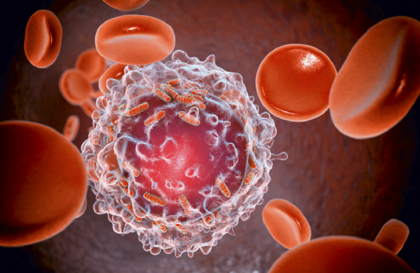 علاج لسرطان الدم الليمفاوي بلا كيماوي