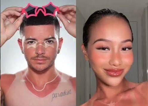 ترند حروق الشمس.. غضب في فرنسا وتحذيرات من مخاطر قاتلة