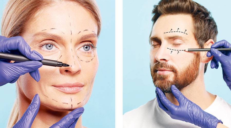 جراحات التجميل.. ساحة سباق بين النساء والرجال