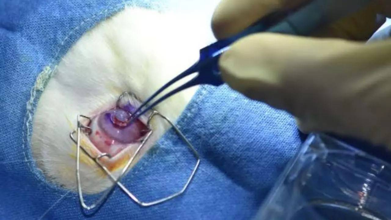 لأول مرة.. زراعة قرنية مطبوعة «ثلاثية الأبعاد» في إنسان