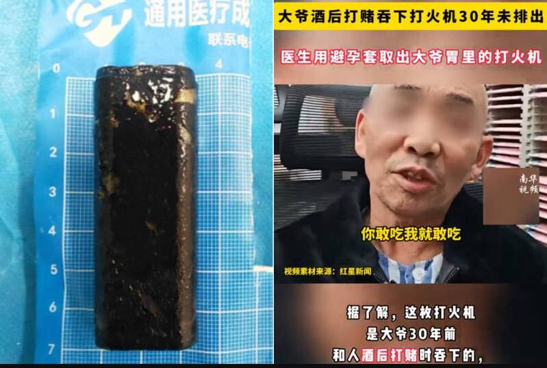 دينغ والولاعة التي ابتلعها بعد استخراجها