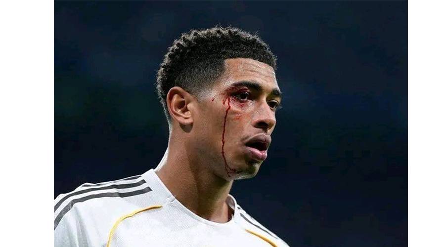 ليلة «دموية» في البرنابيو.. ريال مدريد ينزف قبل الصدام المرعب أمام السيتي