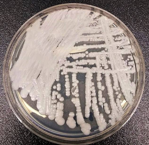 فطر قاتل مقاوم للعلاج ينتشر في مستشفيات أمريكية