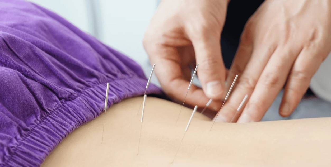 ممارس يثبت إبراً على ظهر مريض