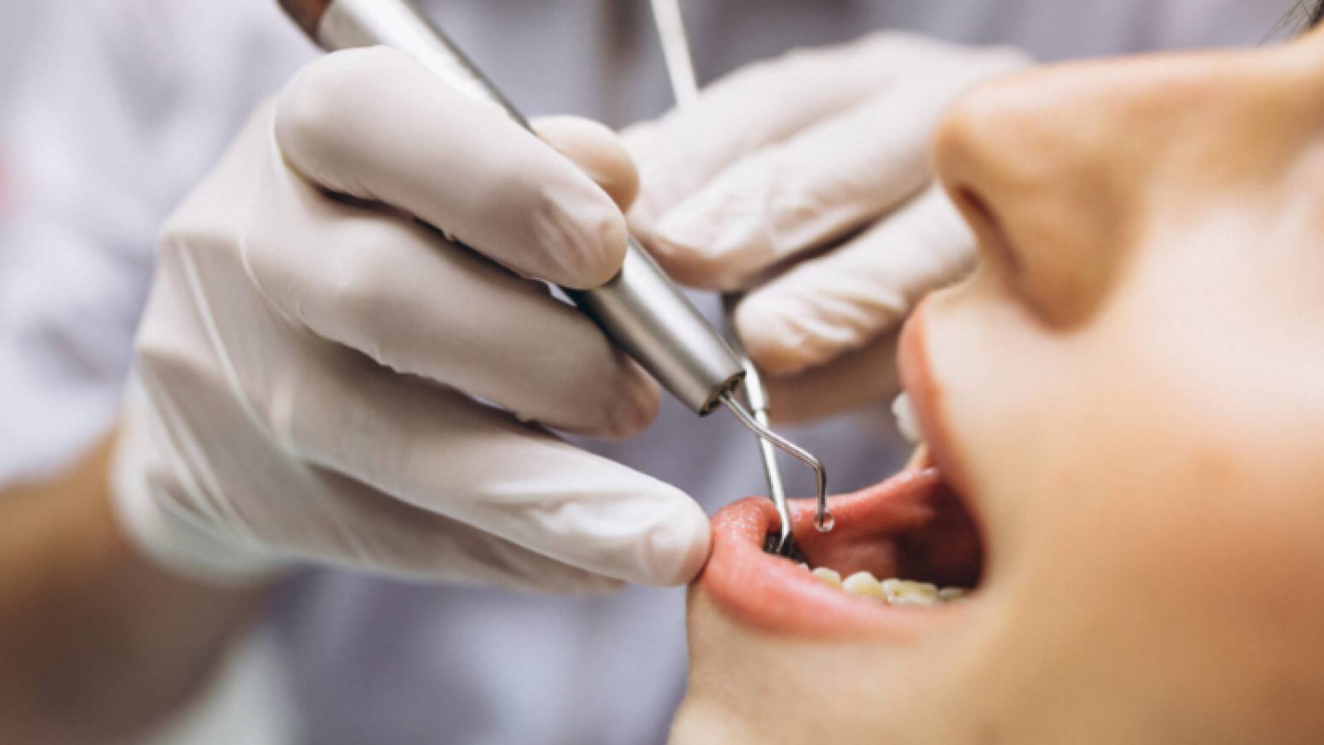 «أطباء الأسنان» الأردنية تحيل 25 منتحلاً للقضاء