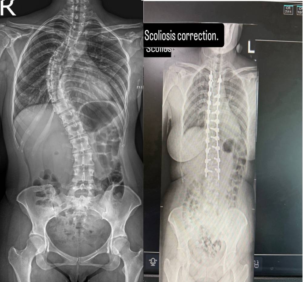 «المستشفى السعودي الألماني» ينهي معاناة مريضة بعد 30 عاماً