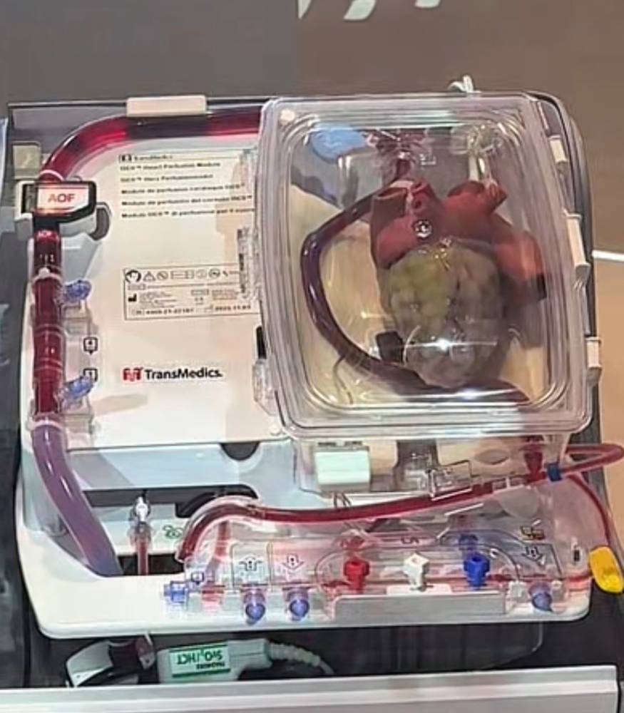 «حياة».. أسرع برامج التبرّع وزراعة الأعضاء نمواً عالمياً