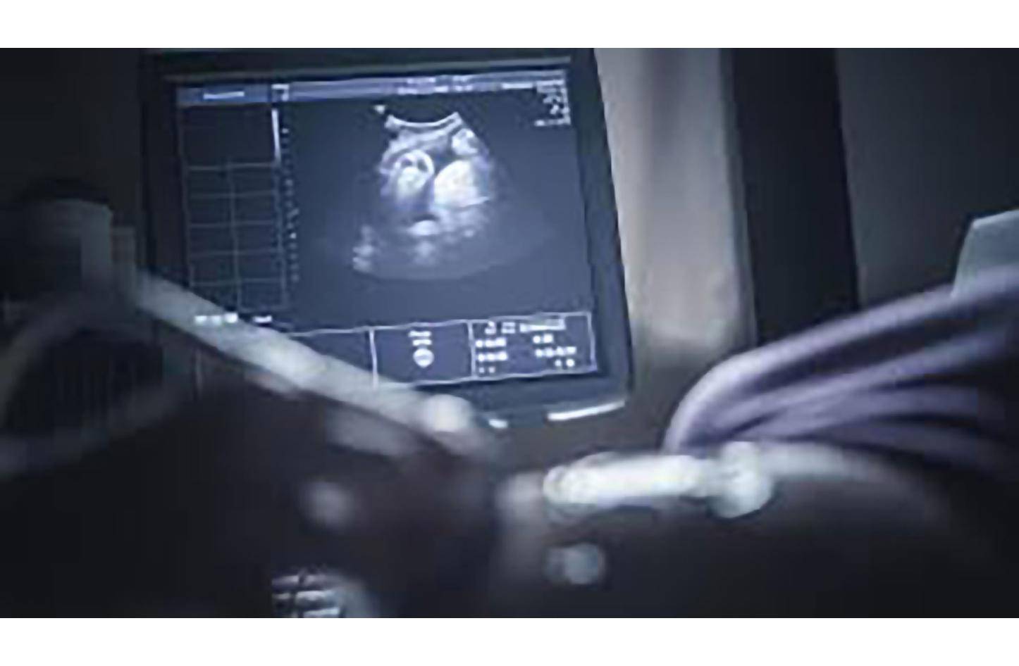 فحص مريضة بواسطة جهاز السونار