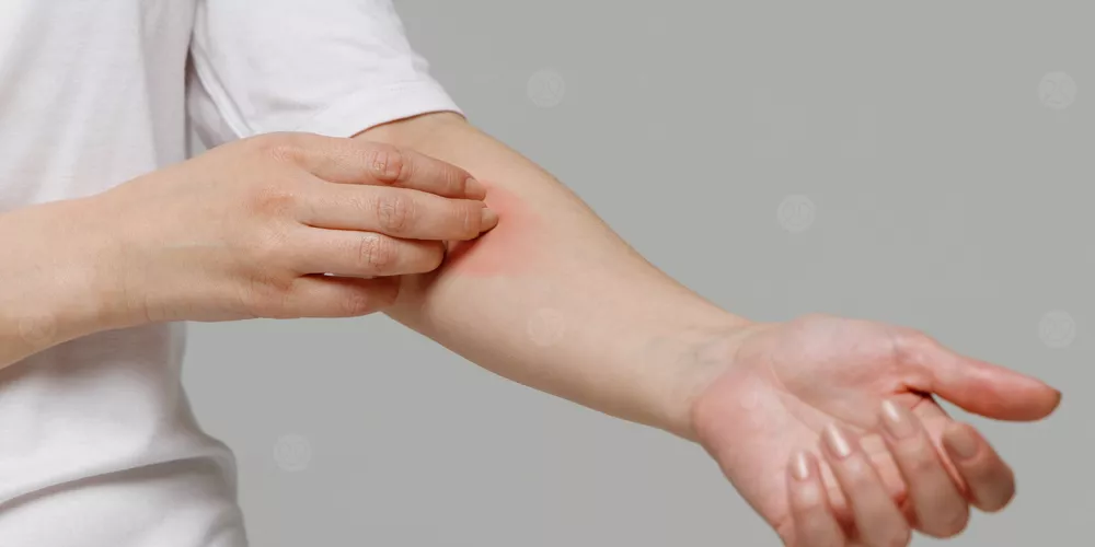 الملايين يعانون الحكة المزمنة