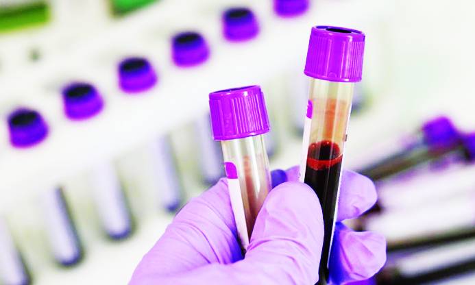 هل فحص الدم يؤثرُ في صحة الصيام؟