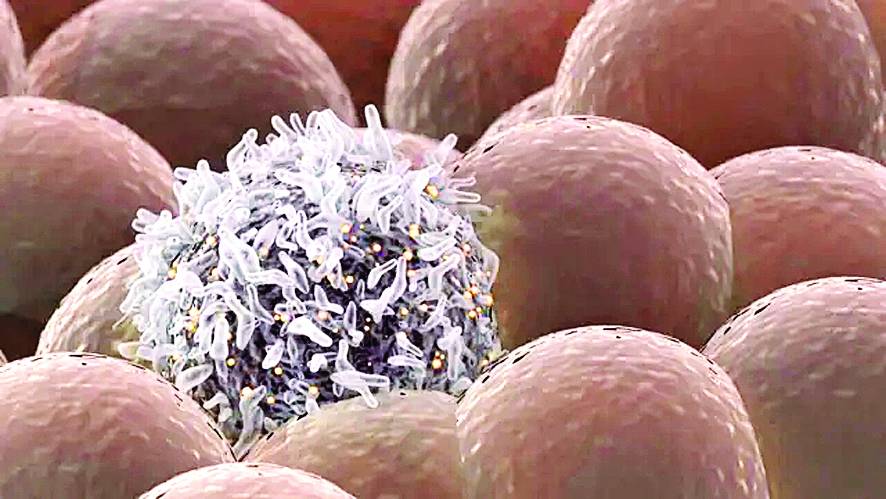 رسم حاسوبي لخلية سرطان الثدي