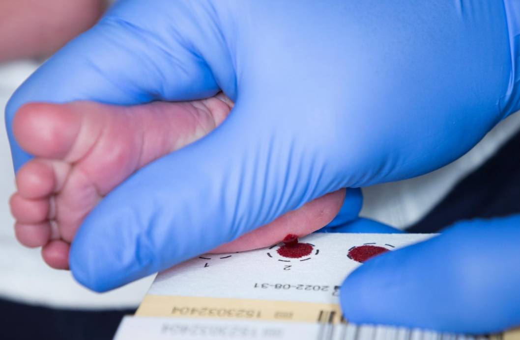 اسكتلندا تفحص المواليد للكشف عن «ضمور العضلات»